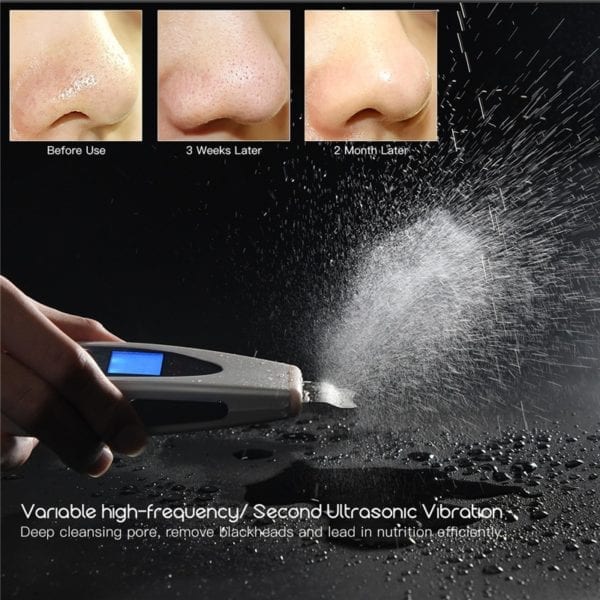 Ultrasonic Skin Scrubber Deep Face Cleaning Machine Remove Dirt Blackhead Peeling Lifting Anti Aging Facial Cleaner 1